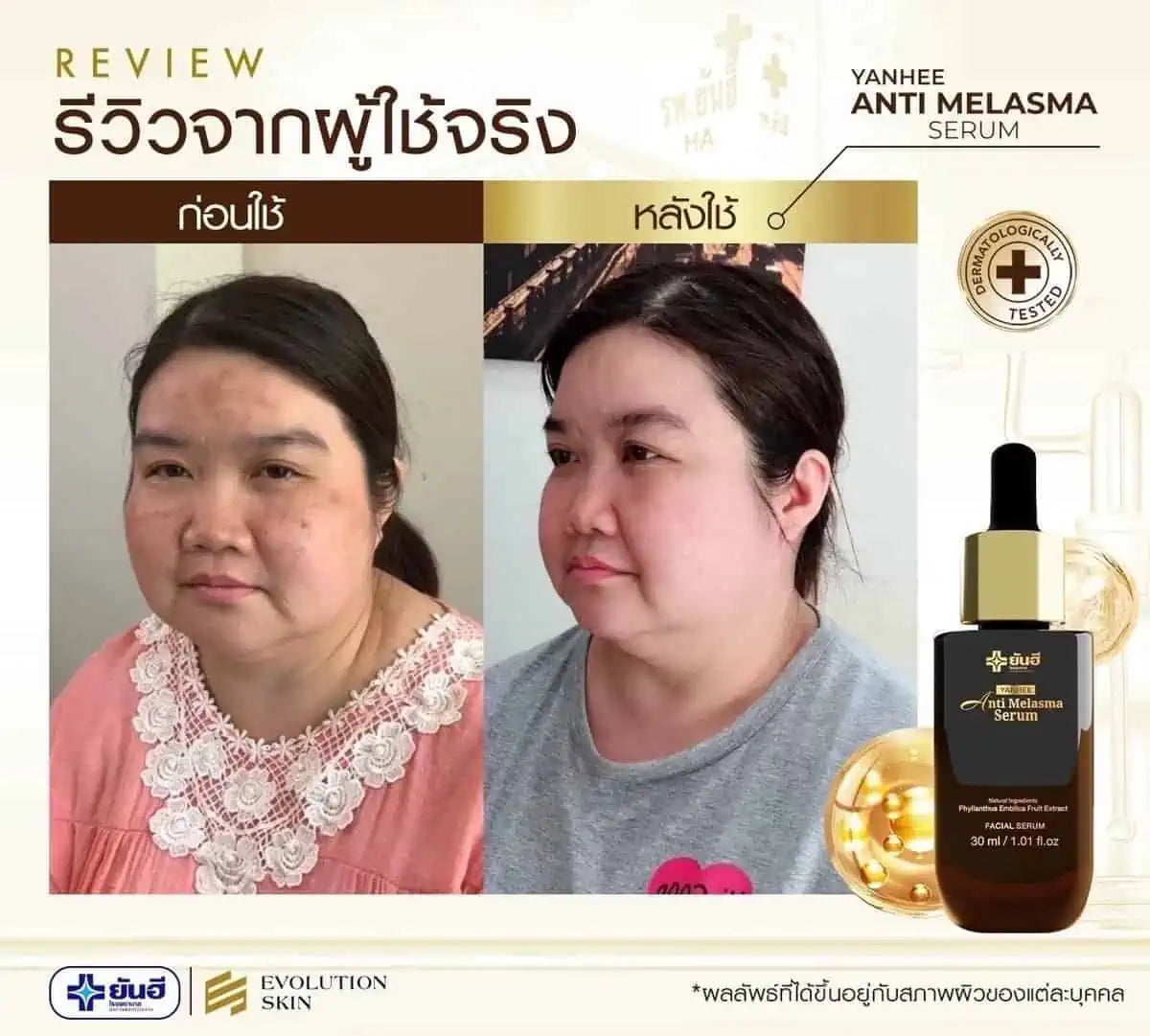 ครีมเซรั่มทาฝ้า-ยันฮี