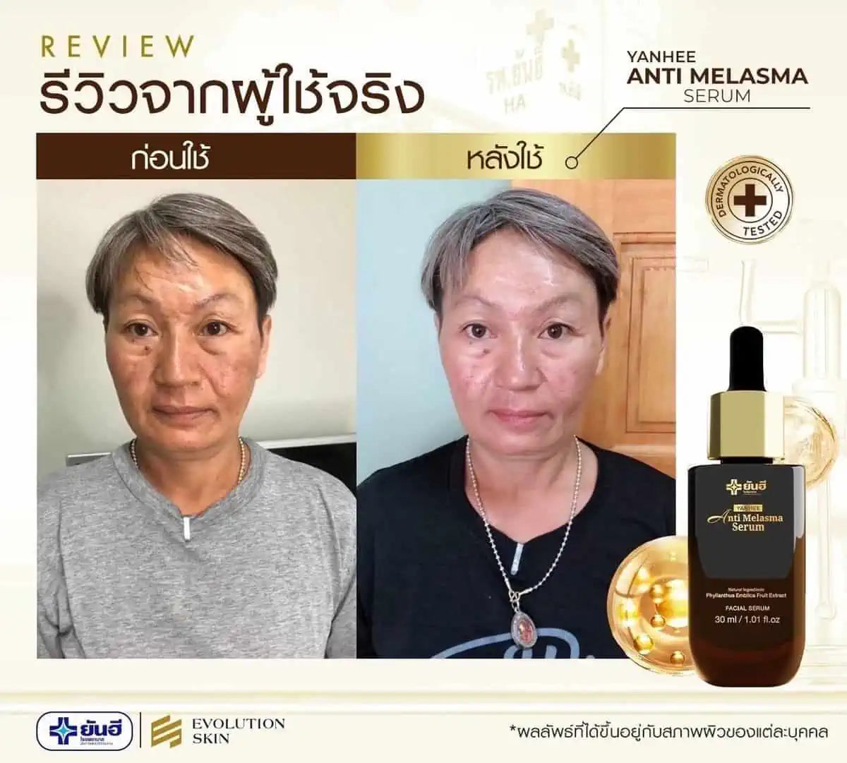 ครีมเซรั่มทาฝ้า-ยันฮี