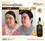 เซรั่มทาฝ้า-ยันฮี