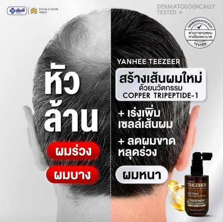 เซรั่มปลูกผม-ยันฮี