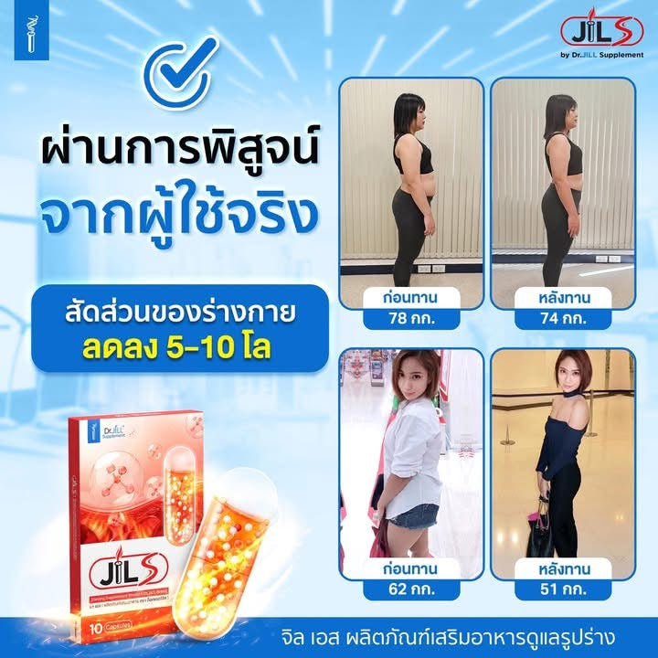 ดร.จิลล์ ส- ดเตอร์จิว วัส